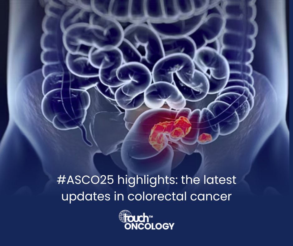 touchONCOLOGY's tweet image. 🌟 What are the latest updates in colorectal cancer? #ASCO25 highlights you shouldn’t miss!

⬇️ Hear insights from Dr Frank Sinicrope &amp;amp; explore key trial developments:
🔗 touchoncology.com/insight/asco25…

@amerseburger @FASinicropeMD @MayoClinic
#ColorectalCancer #GICancer #Oncology