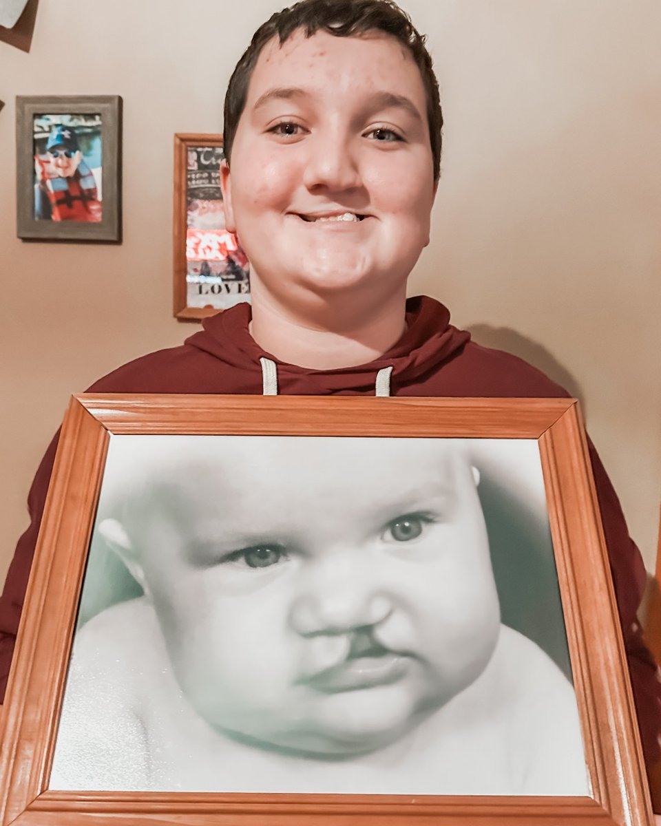 ShrinersChicago's tweet image. Zach has been a patient in the cleft lip and palate clinic @ShrinersChicago since he was just a few weeks old. His family is grateful to our multidisciplinary team for helping him gain self-confidence. Learn more shrinerschildrens.org/en/pediatric-c…. #CleftandCraniofacialAwareness