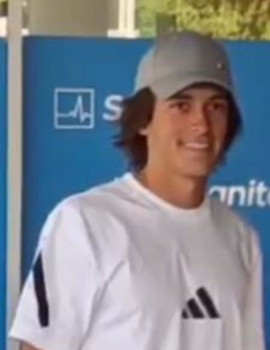 Le presentaron ayer con peluca y gorra y hacen esto hoy para disimular, a mi no me la cuelan.