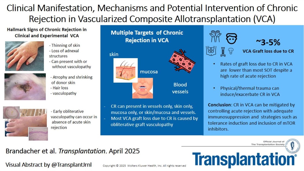 This new overview explores Chronic Rejection across tissue types, its pathophysiology, and emerging therapies like complement &amp; checkpoint inhibitors. A must-read for the future of transplant care by <a href="/JohnsHopkins/">Johns Hopkins University</a>. #TXPforAll #Transplantation tinyurl.com/p8ek3eff