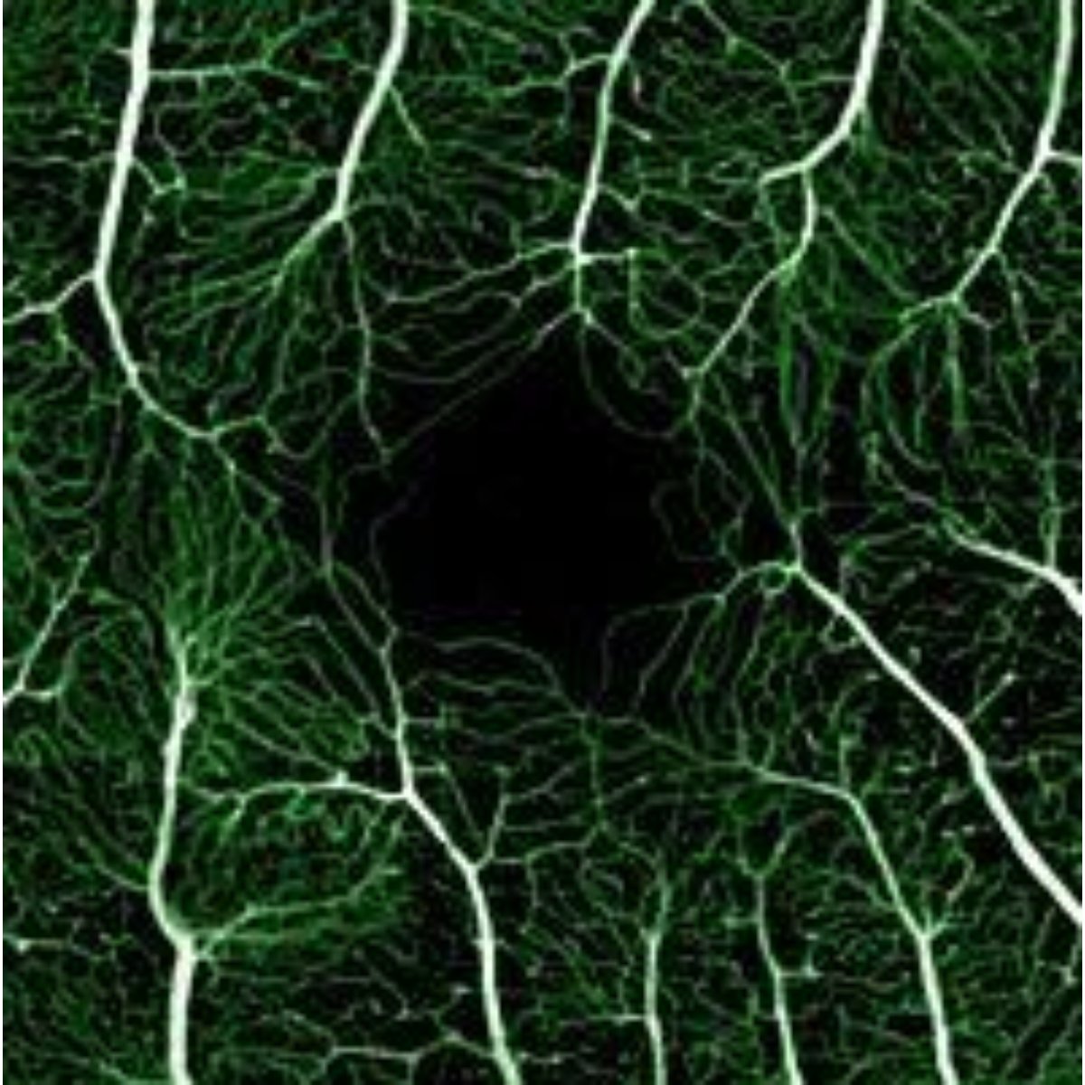 NatEyeInstitute's tweet image. July’s image of the month features branching blood vessels that surround the central part of a retina. For ease of viewing, the blood vessels have been lit up green by fluorescein angiography combined with adaptive optics.
brnw.ch/21wUbT7
#ImageOfTheMonth