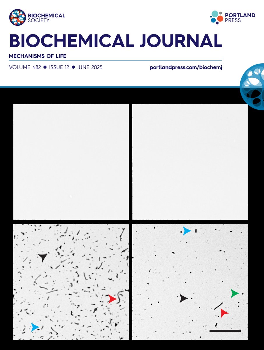 Biochem_Journal's tweet image. Explore the latest issue of the Biochemical Journal! Featuring the latest research into the aetiopathogenesis of Parkinson’s disease, tau biology, the CRISPR system, arginine metabolism, heme-regulated inhibitor, and cytochrome P450 4A11. ow.ly/m9ZG50WoUor