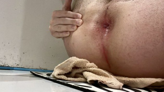 ð
âðððððð ððð ðŒððððŒð ð (@expose_alphas) on Twitter photo â€ïž ððððð¿ð : <a href="/monculavous/">Passifafond</a>
ð ðŒðð : 22 ans
ð«ð· ððððð : Charleville-MéziÚres (08)
ð¥ ððŒððððŸðððŒðððð : Envie de deglinguer une bonne lope qui a toujours la dalle et nâest jamais rassasiée ? Alors Foncez ouvrir la chatte de ce jeune passif, et étanchez sa â€ïž ððððð¿ð : <a href="/monculavous/">Passifafond</a>
ð ðŒðð : 22 ans
ð«ð· ððððð : Charleville-MéziÚres (08)
ð¥ ððŒððððŸðððŒðððð : Envie de deglinguer une bonne lope qui a toujours la dalle et nâest jamais rassasiée ? Alors Foncez ouvrir la chatte de ce jeune passif, et étanchez sa