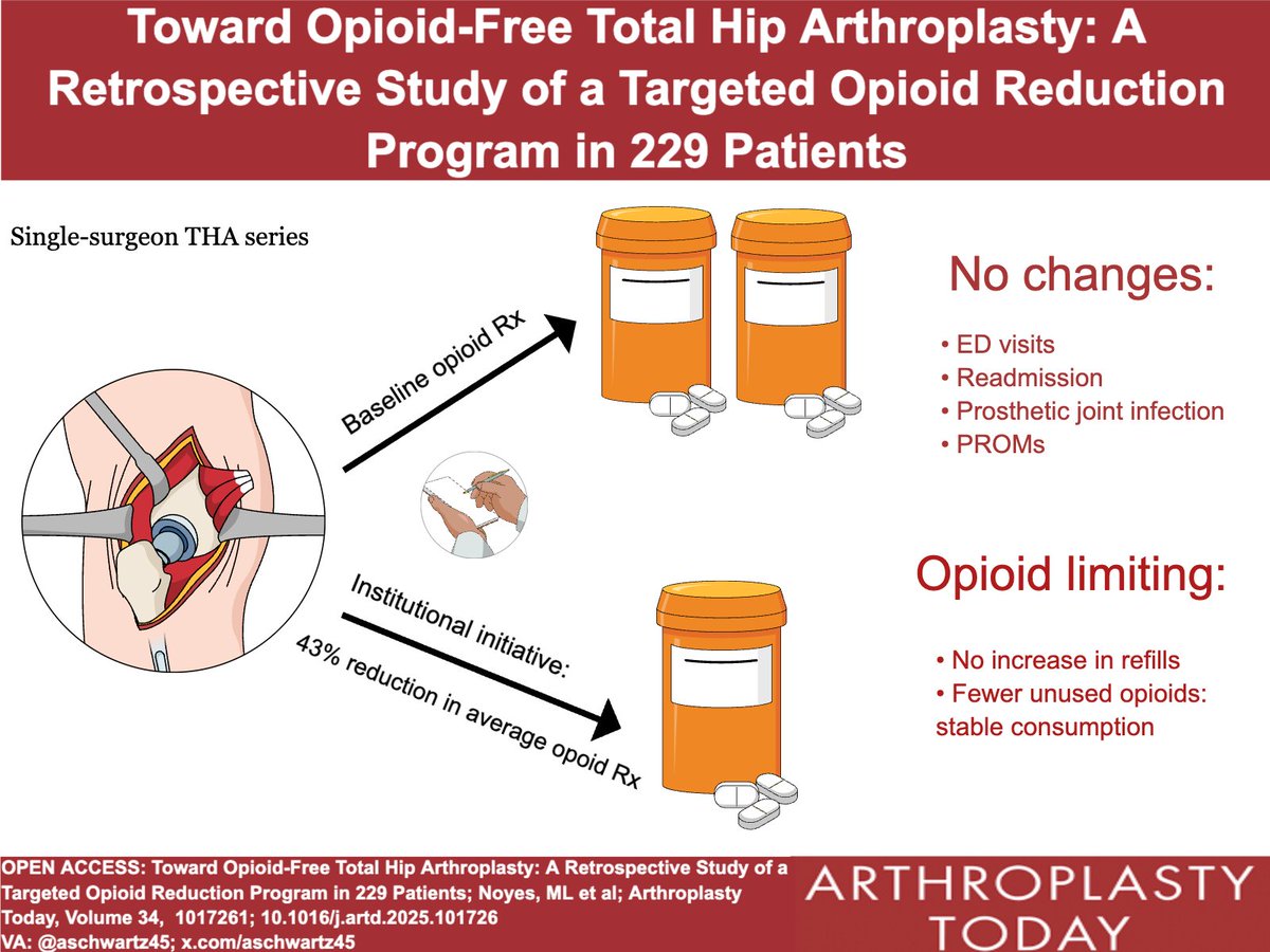 Arthroplasty Today (@arthrotoday) on Twitter photo D.A.R.E. to limit opioid prescriptions.
Lowering discharge dose of opioids resulted in fewer unused pills. What are other strategies to limit opioids? <a href="/DrAdamRana/">Adam Rana, MD</a> <a href="/HipSurgeryNYC/">Jonathan Vigdorchik</a> <a href="/BrdgPlt2Nowhere/">BridgePlate2Nowhere</a>
arthroplastytoday.org/article/S2352-…
VA: <a href="/aschwartz45/">Andy Schwartz</a> D.A.R.E. to limit opioid prescriptions.
Lowering discharge dose of opioids resulted in fewer unused pills. What are other strategies to limit opioids? <a href="/DrAdamRana/">Adam Rana, MD</a> <a href="/HipSurgeryNYC/">Jonathan Vigdorchik</a> <a href="/BrdgPlt2Nowhere/">BridgePlate2Nowhere</a>
arthroplastytoday.org/article/S2352-…
VA: <a href="/aschwartz45/">Andy Schwartz</a>