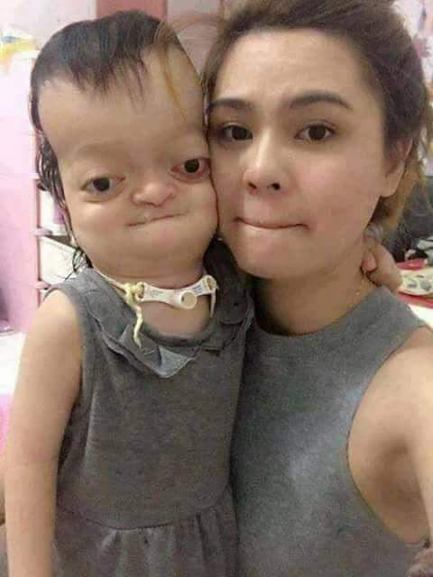 Her father Says she can't get many likes because she has Down Syndrome and ugly😓 If you think she's beautiful hit a Like and comment #AMEN 🙏Please👍