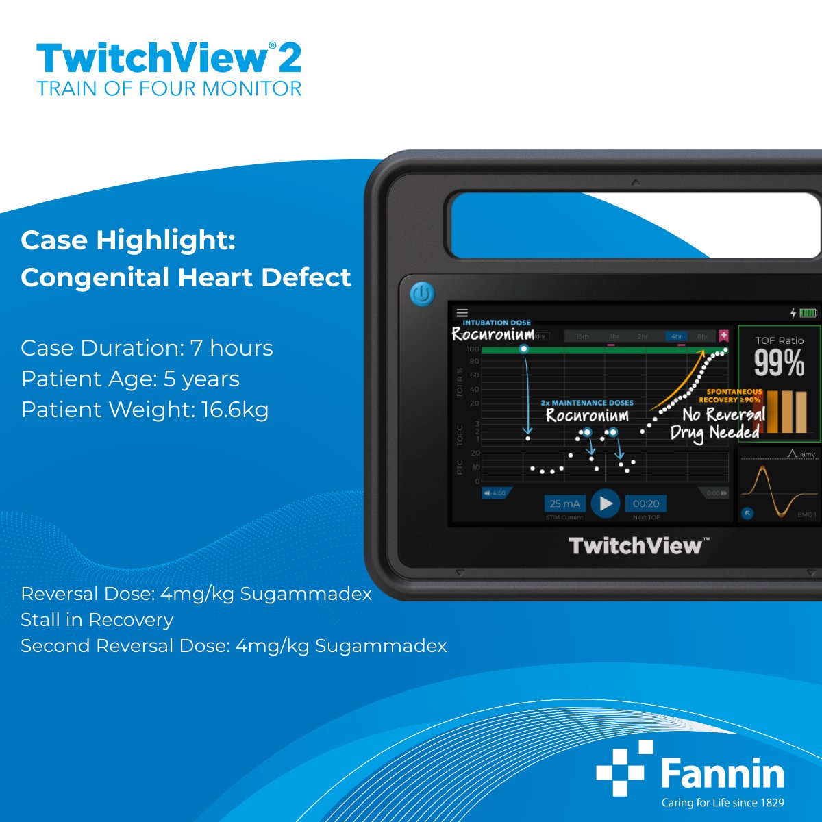 ⚠️ One reversal dose may not be enough. In a paediatric case, full recovery only occurred after a second Sugammadex dose. Real-time monitoring with TwitchView® proved essential. Now available via Fannin UK: lnkd.in/gzZh7mJE #PatientSafety