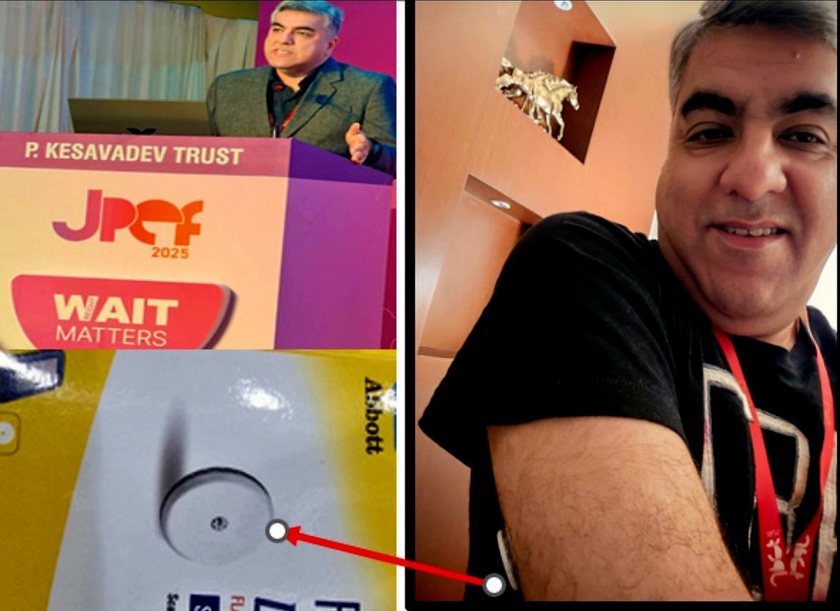 🔬 FreeStyle Libre 2 iCGM: The New Standard in Real-Time Glucose Monitoring

CME INDIA–update  based on  inputs from Dr. Manoj Chawla , Diabetologist,Mumbai
( Launched at JPEF 2025,
Thiruvananthapuram)
✅ Key Scientific Highlights:

📊 The only iCGM with 1-minute glucose updates,