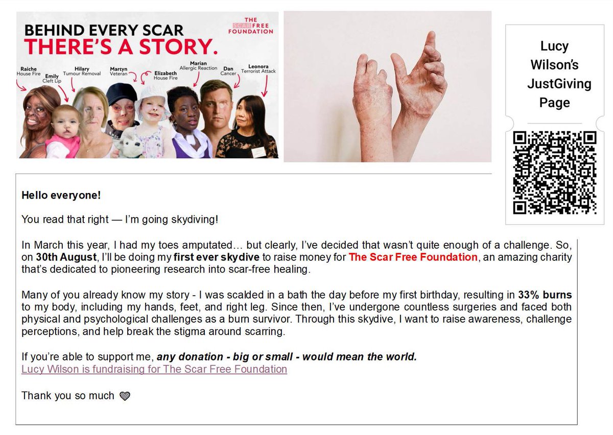 Lucy Le (@lucyletweet) on Twitter photo On the 30th August I will be doing my very first skydive to raise money for <a href="/scarfreeworld/">Scar Free Foundation</a>.
Any donations - big or small - would truly mean the world.
Thank you.
justgiving.com/page/lucysskyd… On the 30th August I will be doing my very first skydive to raise money for <a href="/scarfreeworld/">Scar Free Foundation</a>.
Any donations - big or small - would truly mean the world.
Thank you.
justgiving.com/page/lucysskyd…