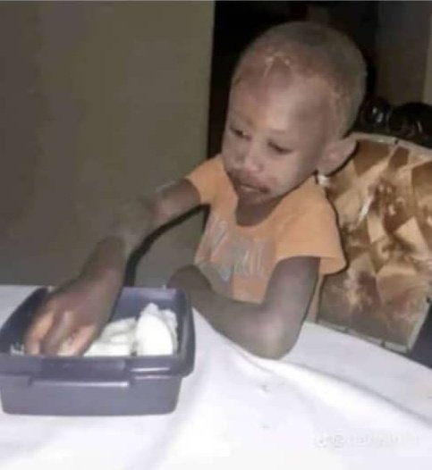 Pedza kudya utiudze kuti chikorokoza wakatanaga rinhi?