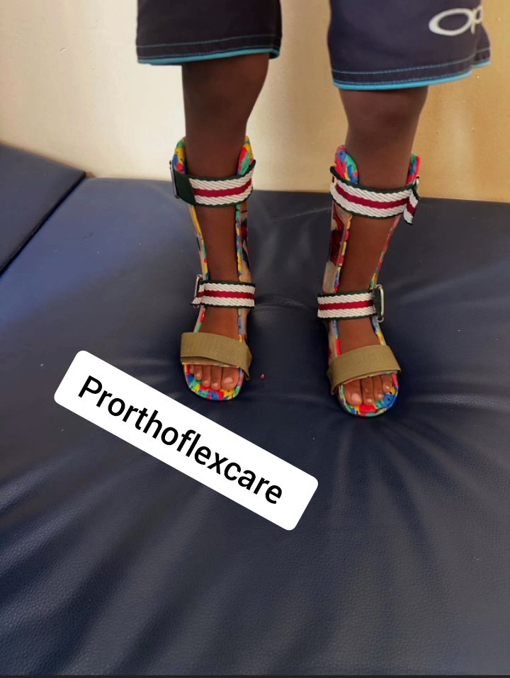 prostheticng's tweet photo. Custom-made AFO (Ankle-foot-orthosis) designed to enable mobility, enhance stability in a standing position, and provide support for individuals with gait / mobility issues.

Who benefits from an AFO?
• Foot drop 
• Ankle instability 
• Cerebral Palsy, etc

#footconditions https://t.co/W7qBNWoeXD