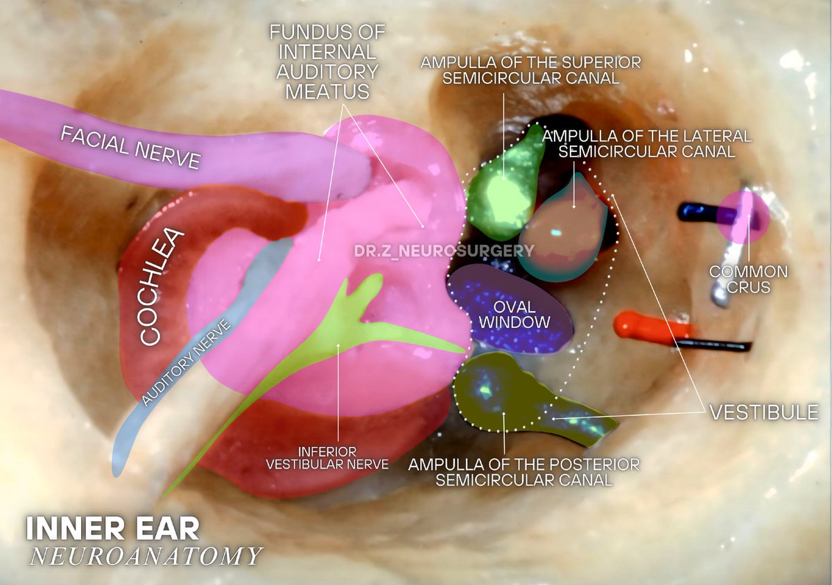 A closer look at the inner ear home to the cochlea, vestibule, and semicircular canals.
These tiny structures help us hear sounds and stay balanced every day.
#Neuroanatomy #InnerEar #MedicalEducation #Anatomy #Neuroscience