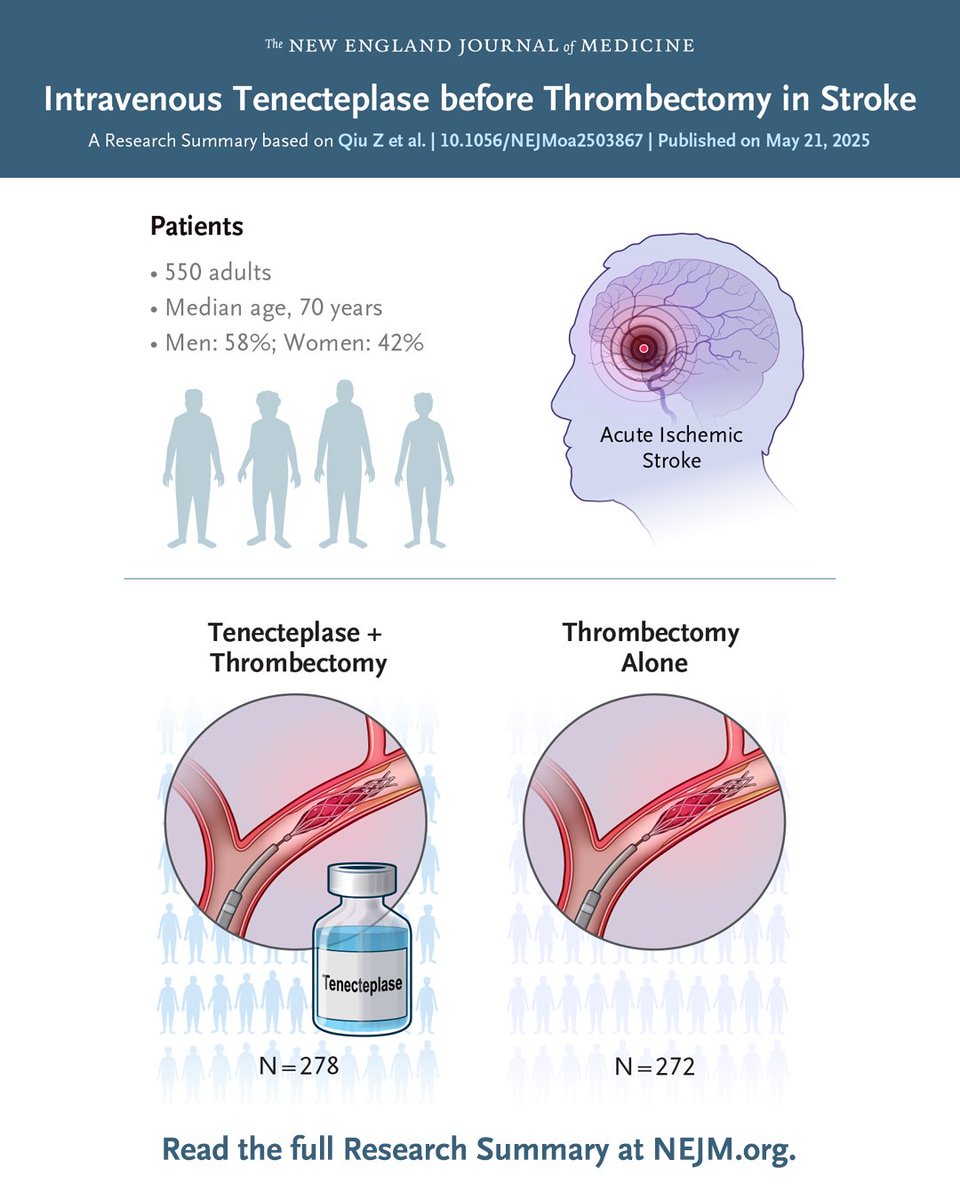Among 550 patients with stroke due to large-vessel occlusion who had presented within 4.5 hours after onset, 90-day functional outcomes were better with intravenous tenecteplase before thrombectomy than with thrombectomy alone. Full BRIDGE-TNK trial results and Research Summary: