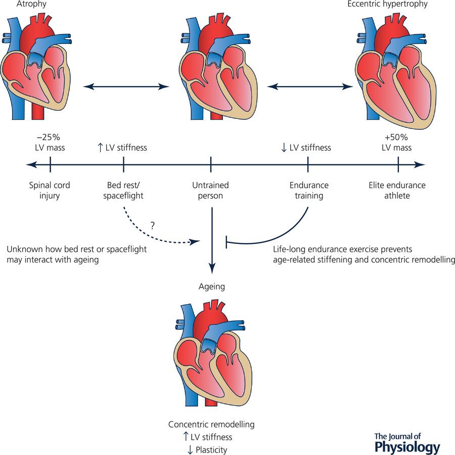 Journal of Physiology (@jphysiol) on Twitter photo This #TopicalReview by Eric T. Hedge (<a href="/Aging_Institute/">Schlegel-UW Research Institute for Aging</a>) et al. examines #plasticity of the heart in response to changes in physical activity 🫀 🏃
📖 Read it here: buff.ly/ygkD23q This #TopicalReview by Eric T. Hedge (<a href="/Aging_Institute/">Schlegel-UW Research Institute for Aging</a>) et al. examines #plasticity of the heart in response to changes in physical activity 🫀 🏃
📖 Read it here: buff.ly/ygkD23q