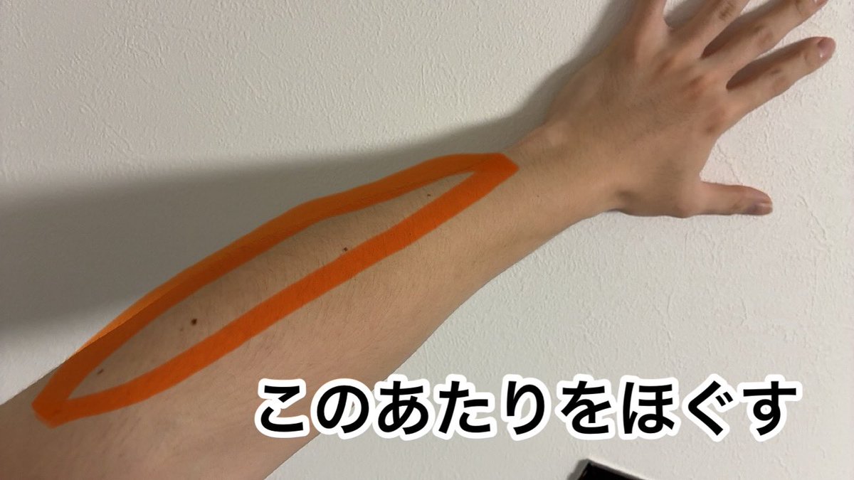 halpip's tweet image. 危険な状態ですのですぐに治療してください。僕が腱鞘炎で打鍵出来なくなった時と同じ症状です。

指が上に上がるなら伸筋(手の甲側)が原因と思われます。画像を参考にかっさで入念にほぐして下さい。練習は症状が改善するまで軽めにしましょう。

かっさはコレがオススメ🔽
loft.co.jp/store/g/g49691…