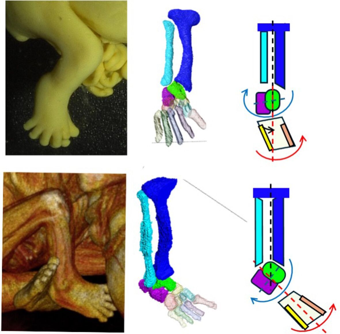 AnatRecord's tweet image. New insights into early foot development: 3D imaging reveals how fetal ankle & foot posture evolves. A new study shows that twisting, supination & bone shape shifts start as early as the embryonic period.
Takakuwa et al.: anatomypubs.onlinelibrary.wiley.com/doi/10.1002/ar…