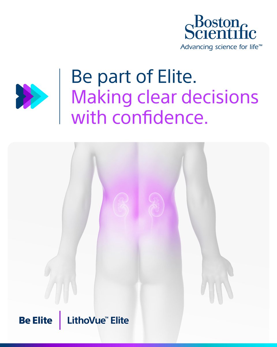 Elevated #intrarenalpressure (IRP) may lead to post-operative complications such as sepsis (Tokas et al. 2018).

LithoVue™️ Elite monitors IRP in real-time, putting the right information at your fingertips.

Understand how: bit.ly/44JnLmj
 
#BSCEMEA #BeElite