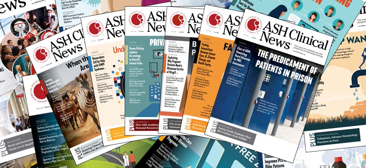 ASHClinicalNews's tweet image. ASH Clinical News is seeking associate editors! Editors have the opportunity to share their views on topics in #hematology, participate in content development, and provide subject matter expertise. For more information and to apply by August 15, visit: ow.ly/OG5050WnYfS.