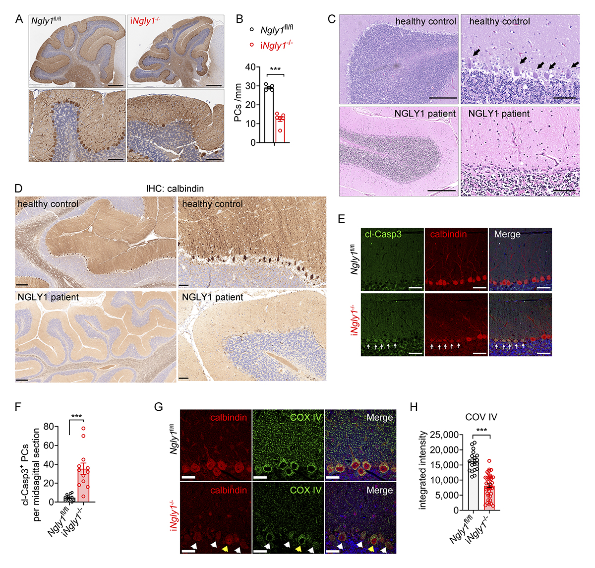 JExpMed's tweet image. Nan Yan lab describe an inducible Ngly1 knockout mouse model, iNgly1−/−, that reveals pronounced loss of Purkinje cells in the cerebellum w/out neuroinflammation. Sting1 knockout or STING inhibitor VS-X4 significantly rescues iNgly1−/− disease in mice. hubs.la/Q03x3QwQ0