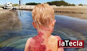 FALLO VALIOSISIMO EN DEFENSA DE LA POBLACION AFECTADA POR LA CONTAMINACION AMBIENTAL !!!
La Camara Federal  de Casacion Penal, Sala IV, hizo lugar al Recurso de Casacion que interpuse con la Dra. Maria Carpineto, en representacion del Sr. Roberto Maturana, revocando un fallo del