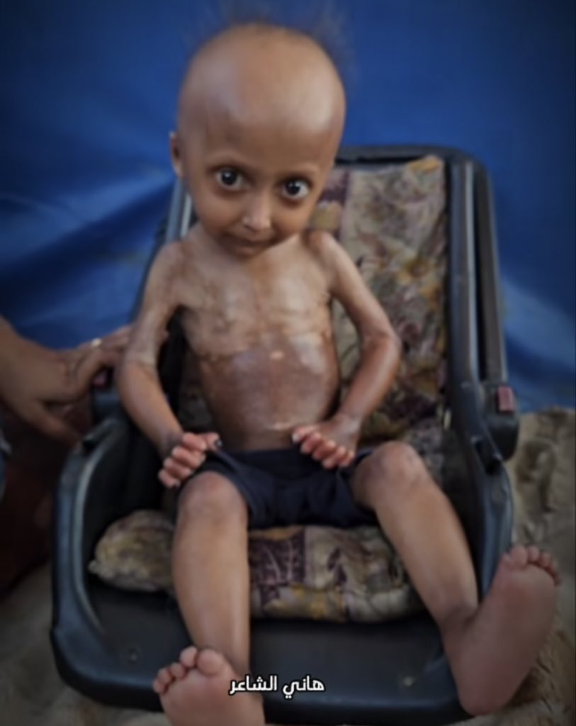 STARVATION 💔 Pass this picture 💔