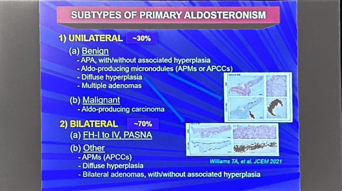 MWeintraubMD's tweet image. Primary aldosteronism is the most common cause of endocrine-related hypertension
Dividing into unilateral and bilateral disease is a gross oversimplification
Excellent talk by Dr. Michael Stowasser at #ENDO2025