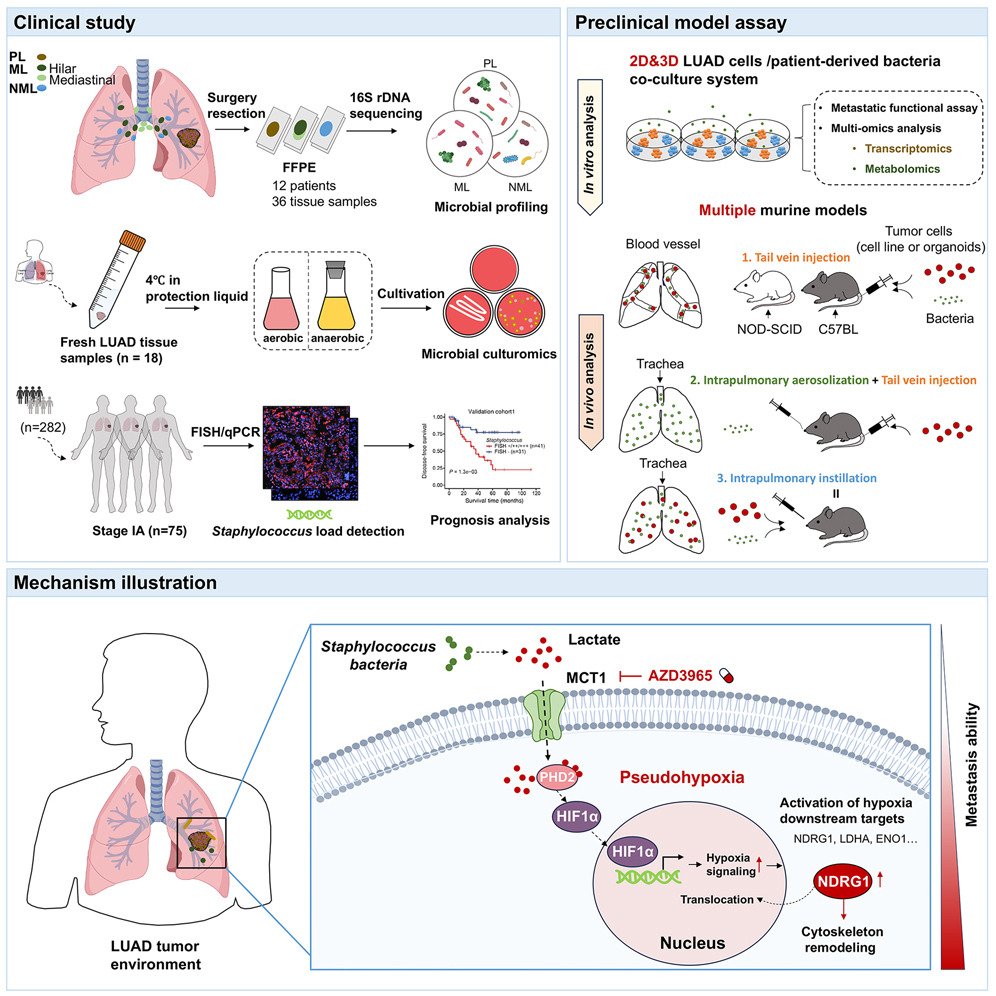 cellhostmicrobe's tweet image. Staphylococcus promotes metastasis:
· Staphylococcus enriched in metastatic lung tumor lesions
· S. nepalensis & S. capitisl-secreted lactate promotes metastatic potential via MCT1-mediated pseudohypoxia signaling
· MCT1 inhibition abolishes metastasis
cell.com/cell-host-micr…