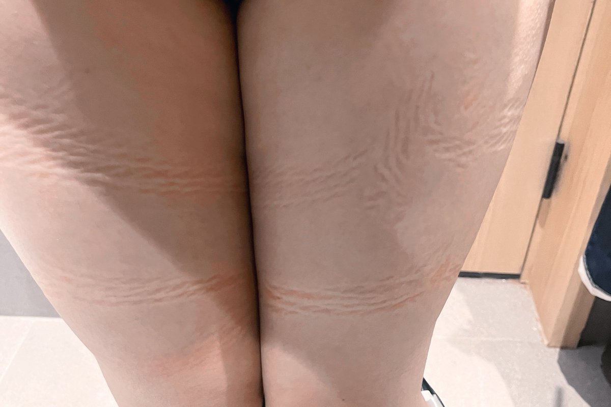 7/11 
上星期五獨自上了廣州參加 <a href="/bakushi518YR/">鵺神 蓮＠縛師</a> 的繩縛體驗。
是第二次被鵺神蓮老師綁綁了，和上次完全不同的綁法但也超喜歡。
每一次的繩縛也能給我思想和感覺上的衝擊✨

非常感謝老師很體貼我兩星期前莫名其妙勞損了的身體🥹在沒有綁右手的情況之下也凌空吊起來
很喜歡！！