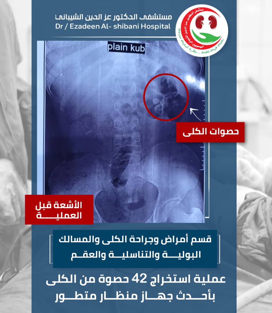 مستشفى الدكتور عز الدين الشيباني (@ezhospital1) on Twitter photo 