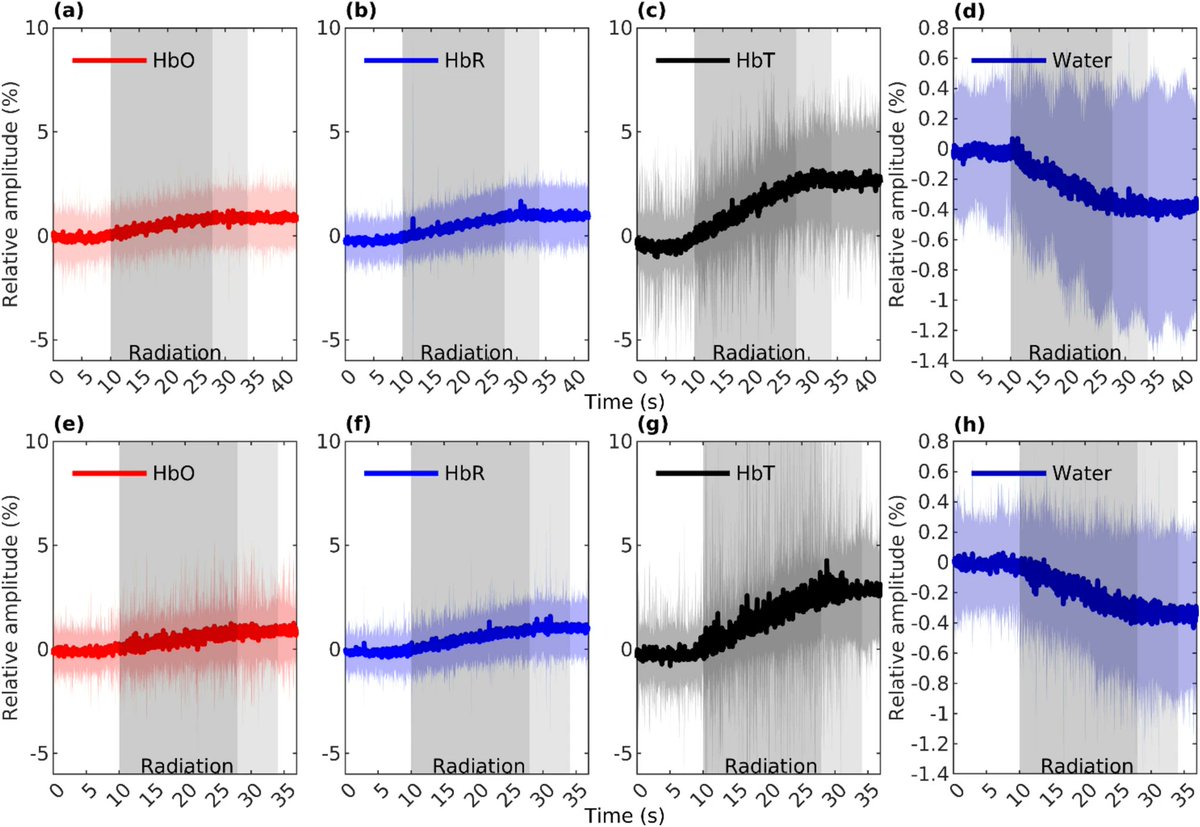 ABMEjournal's tweet image. Radiation therapy doesn’t just work over time – it starts changing the brain within seconds of treatment beginning.
Researchers monitored cerebral changes in real time during whole brain radiotherapy (WBRT), using functional near-infrared spectroscopy. They tracked 31 patients…