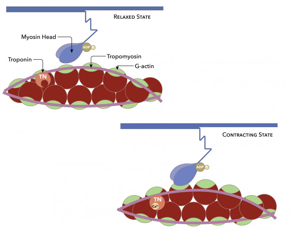 emergmedottawa's tweet image. EMOttawa JC
🩺 Can a 0/1-hour troponin protocol boost safe discharges from the ED?
A new stepped-wedge RCT across 9 US EDs finds no significant increase in discharge rates vs 0/3-hour protocol — but safety is maintained.
🔗 emottawablog.com/2025/07/rapid-…
#FOAMed #EmergencyMedicine