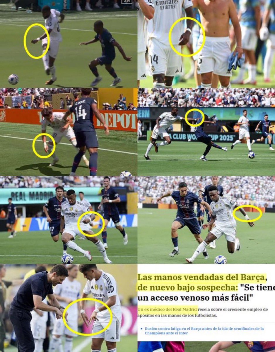 🚨Ex-Real Madrid medical director Dr. Mihic speaks on the bandages around the Madrid players wrists

Dr. Mihic stated, "I don't think it is just a trend," adding "It is common to use the wrist to access veins more easily. However, I don’t know why they are trying to conceal that"