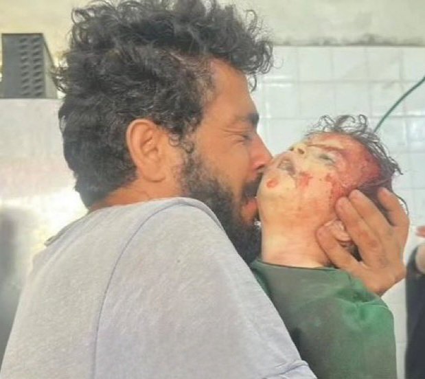 لا يسكت ولا يتخاذل عن هذه الدماء إلا جبان منحط ذليل 

أما الشرفاء فهم من يقفون إلى جانب غزة ويساندونها