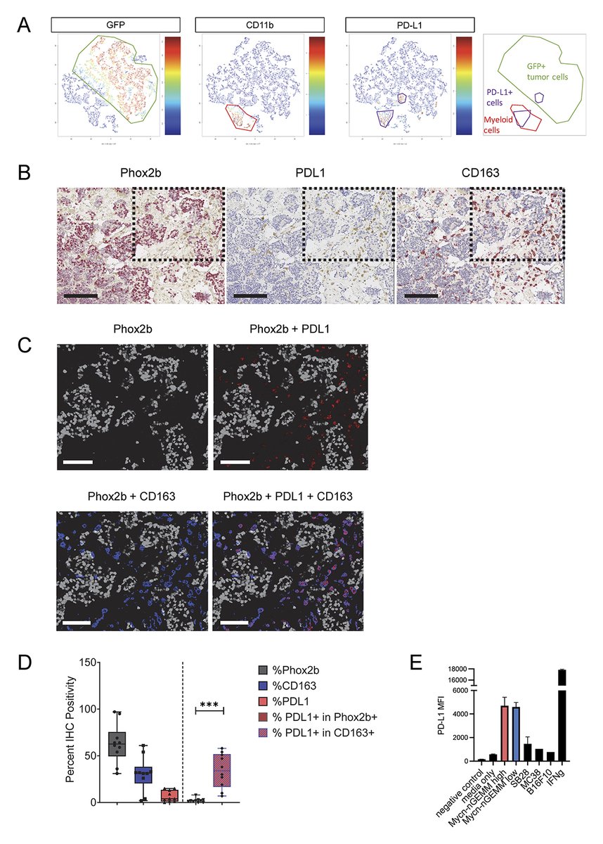 JExpMed's tweet image. Marie Ménard, @HiroyukiYoda, @WAWeissLab @UCSF and colleagues describe a Mycn-nGEMM for neuroblastoma. Murine & human neuroblastomas show profound immunosuppression mediated by PD-L1–expressing TAMs. hubs.la/Q03x48p10