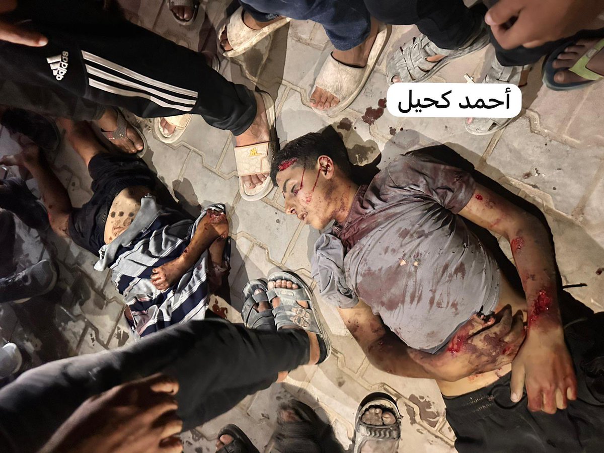 Breaking: The Israeli army has just committed a massacre by bombing the tents of displaced people in central Gaza City, leaving dozens dead and wounded.