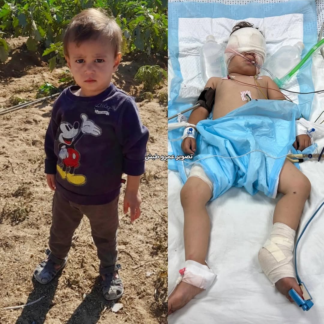 ✔️Gazze'de soykırım devam ediyor
✔️Gazze'de açlık ve susuzluk devam ediyor

✔️Gazze İNSAN olanların davasıdır
✔️Gazze'yi Gündemde tutmaya devam edelim

#WhyIsGazaAlone Grok Vatan #GazaHolocaust Gaza #SONDAKİKA #GazaStarving Anne #GazaGenocide Palestine #FreePalestine Hamas
