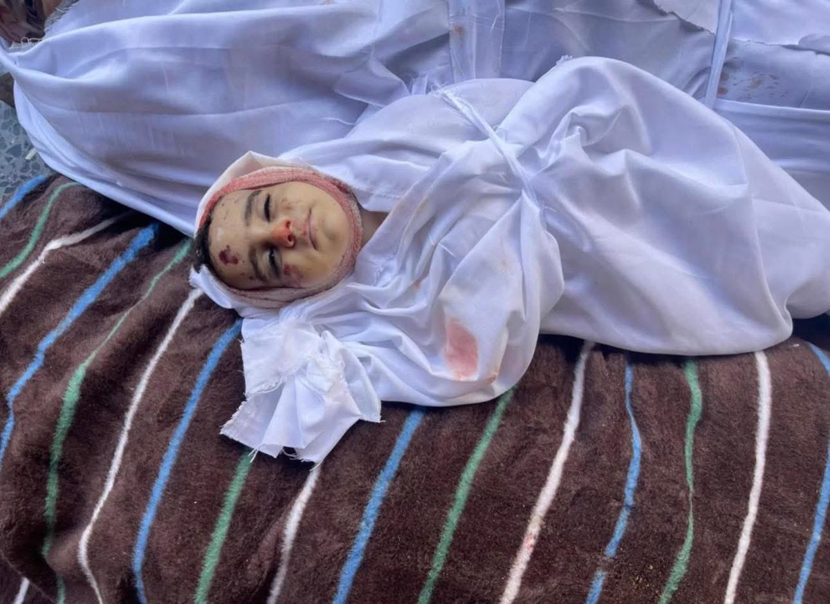 ✔️Gazze'de soykırım devam ediyor
✔️Gazze'de açlık ve susuzluk devam ediyor

✔️Gazze İNSAN olanların davasıdır
✔️Gazze'yi Gündemde tutmaya devam edelim

#WhyIsGazaAlone Grok Vatan #GazaHolocaust Gaza #SONDAKİKA #GazaStarving Anne #GazaGenocide Palestine #FreePalestine Hamas
