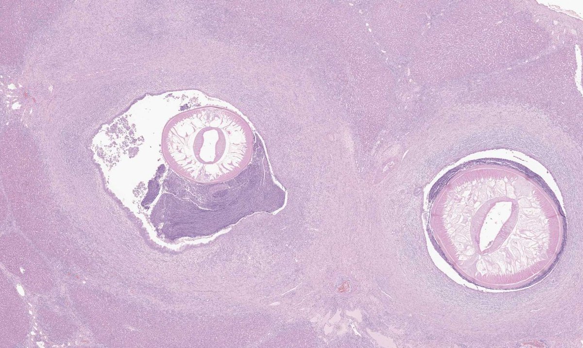 VetPathophile's tweet photo. Ok, Team #VetPath, it's Monday, let's go!
What's the deal with these autopsy findings in a pig?
❓Histopath features
❓Cause
❓Gross lesions
❓Condition https://t.co/GSmJYD3MY2