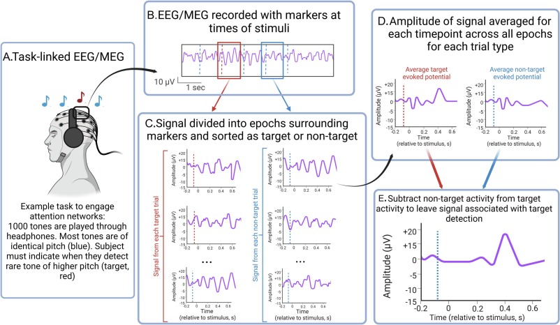 ClinicalNeuroph's tweet photo. [Motor neurone disease] Dukic et al.: "Here, we provide an overview of how EEG/MEG signals have been employed to quantify neural network function in motor neurone disease." Open access: https://t.co/WnM0PdfE1I

#EEG: electroencephalography
#MEG: magnetoencephalography https://t.co/cnx4PTX4cg