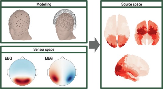 [Motor neurone disease] Dukic et al.: "Here, we provide an overview of how EEG/MEG signals have been employed to quantify neural network function in motor neurone disease." Open access: sciencedirect.com/science/articl…

#EEG: electroencephalography
#MEG: magnetoencephalography