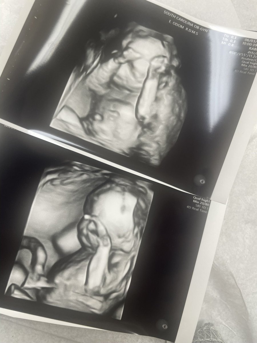 3 more months🥹🥹🥹