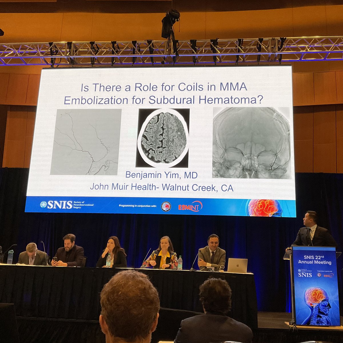 JNIS_BMJ's tweet photo. Dr. Benjamin Yim discusses coil embolization for #MMAembolization for #subduralhematoma. #SNIS2025 @SNISInfo @SNIS_info @esmintsociety @cvsection @fcalbuquerque51 @dr_mchen @DanniDiestro @MattAmansMD @ducruetaf @MattFusco_MD @DrAltschul @cruzcerebri @niko_mou @aliyasiddiqui04 @MajidiShahram