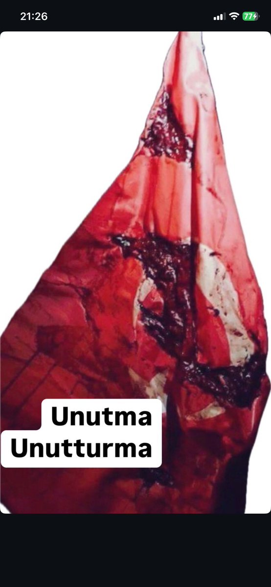 00:00
#15TemmuzuUnutmaUnutturma