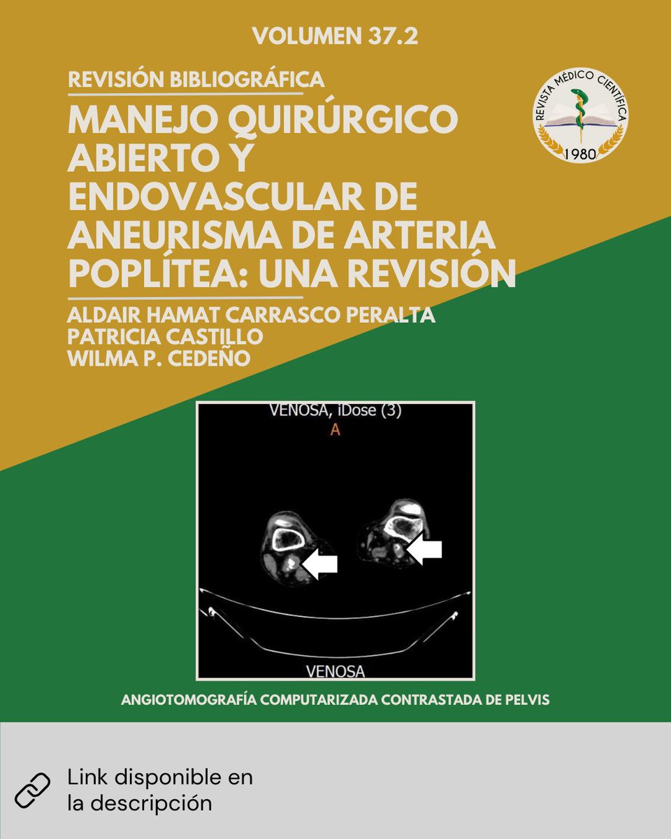 Manejo quirúrgico abierto y endovascular de aneurisma de arteria poplítea: una revisión 🦵

Para acceder a los artículos, les invitamos a visitar el Portal de Revistas Científicas de la Universidad de Panamá: revistas.up.ac.pa/index.php/revi…