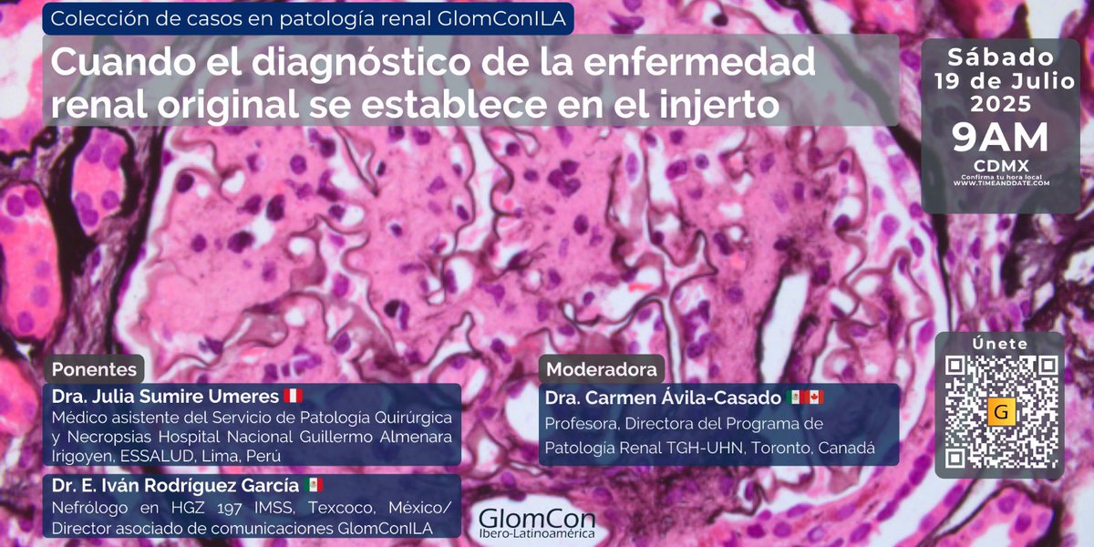 GlomCon Ibero-LatinoAmérica (@glomconila) on Twitter photo 🚨No te pierdas este sábado el seminario:
☞Cuando el diagnóstico de la enfermedad renal original se establece en el injerto
🗓️ 19/Jul/25
🕘 9 am CDMX
👩🏻⚕️Dra. Julia Sumire
👨🏻⚕️Dr. Iván Rodríguez <a href="/goldenglom/">Ivan Rodriguez</a>
Zoom ID: 863 6358 3637
Pass: 343 190
#GlomConILA #GlomConAmor #MeGusta 🚨No te pierdas este sábado el seminario:
☞Cuando el diagnóstico de la enfermedad renal original se establece en el injerto
🗓️ 19/Jul/25
🕘 9 am CDMX
👩🏻⚕️Dra. Julia Sumire
👨🏻⚕️Dr. Iván Rodríguez <a href="/goldenglom/">Ivan Rodriguez</a>
Zoom ID: 863 6358 3637
Pass: 343 190
#GlomConILA #GlomConAmor #MeGusta