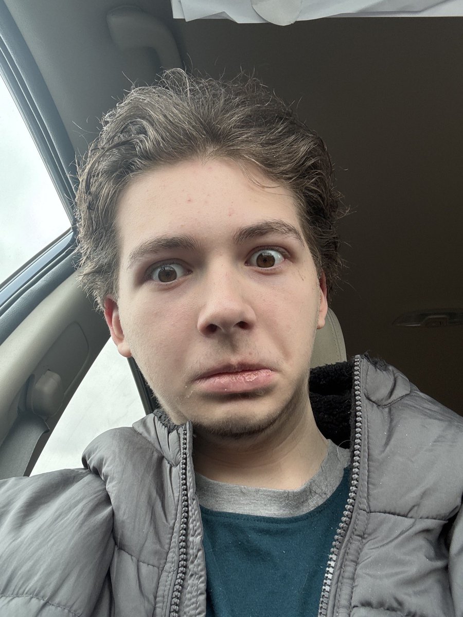 newworld_2007's tweet image. hello  Fellow  Chuds  ..  am  i  Cooked  ?  😔😔