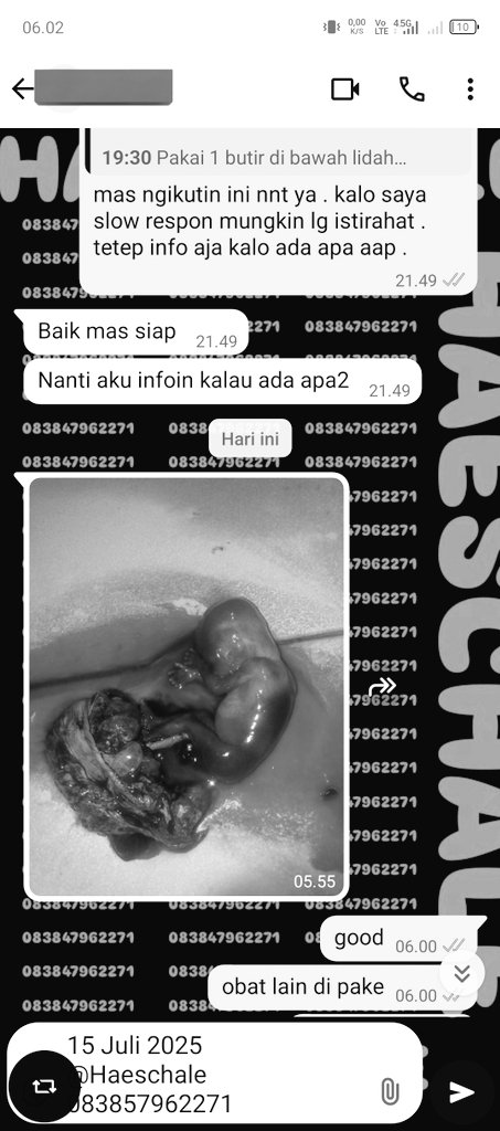 Ready obat pelancar haid / penggugur kandungan 1-6bulan, barang banyak mlimpah harga termurah ,testi buanyak . Konsul gratis ke wa 083847962271 #Misoprostol #gastrul #cytotec #penggugurkandungan #obatpelancarhaid #telatdatangbulan #haid #telat1bln #telat2bln #obatgugurinkandungan