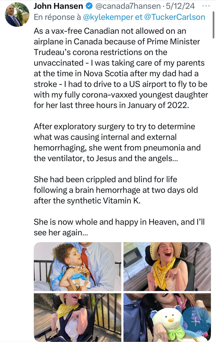 canada7hansen's tweet image. And measles is still a mild illness that confers benefits.

Now do the corona vaccines and the CDC childhood schedule vaccines…