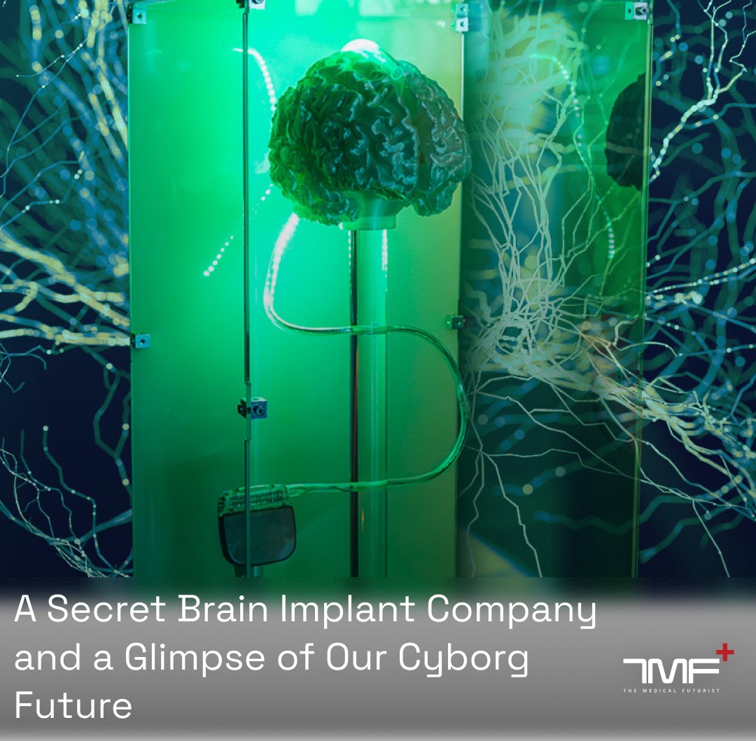 Berci's tweet image. Most of the patients cannot even download their own medical records, but journalists are still very interested in brain-computer interfaces. They might even see the technology as a sign of our cyborg future.
A PCMag journalist could visit the lab of Synchron, a top Neuralink…