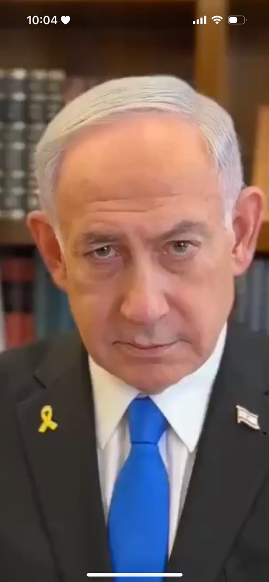 Face of a fag.