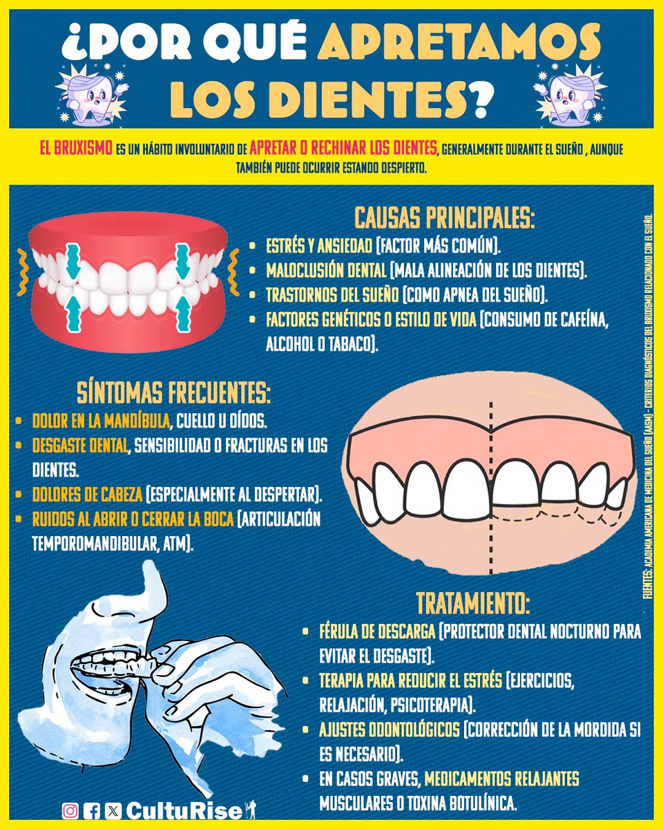 ¿Por qué apretamos los dientes?
#dientes #dientessanos #dientessanos #bruxismo #estres #sueño #sueños #mente #mentesana #cabeza #mandibula #dental #dentallab #dentalart #dentalcare #dentallife #dentalhealth #dentalclinic #dentalschool